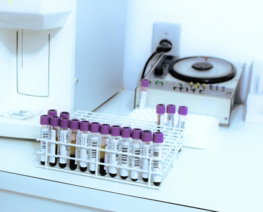 a-machine-with-a-few-tubes.jpg a machine with a few tubes